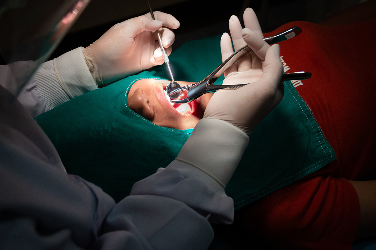 High angle view dentist operating patient